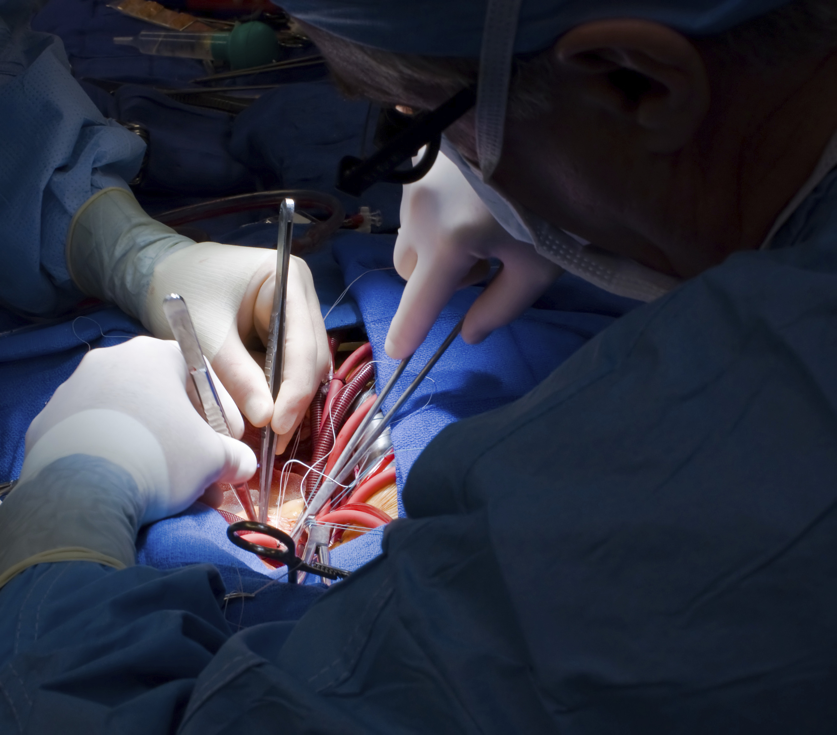 Mass Medical Tourism (2020)